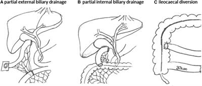 Progressive familial intrahepatic cholestasis—outcome and time to transplant after biliary diversion according to genetic subtypes